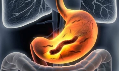 5 نصائح للوقاية من جرثومة المعدة